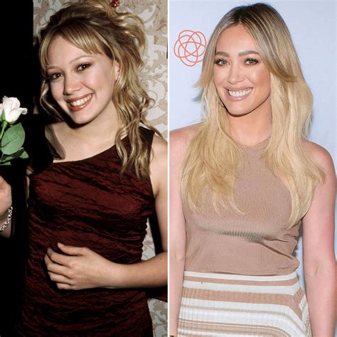 hillary duff plastic surgery|A Look At Hilary Duff’s History With Plastic Surgery